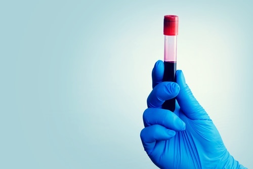 10 Tips for Getting Your Blood Drawn