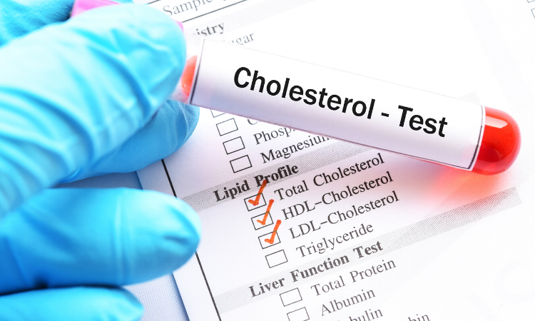 Making Sense of High Cholesterol Warning Signs