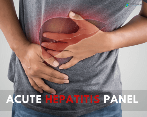 Acute Hepatitis Panel