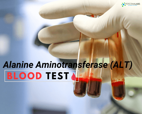 Alt test GPT Blood