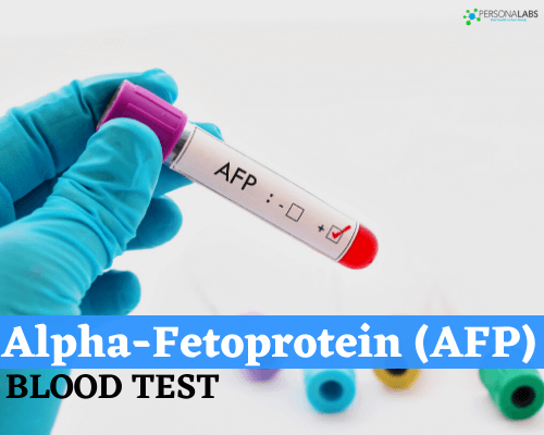 Alpha fetoprotein (AFP)
