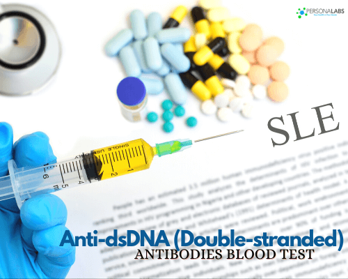 Anti dsDNA (Double stranded) Antibodies