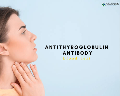Antithyroglobulin Antibodies