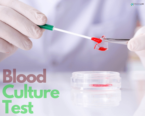 blood culture