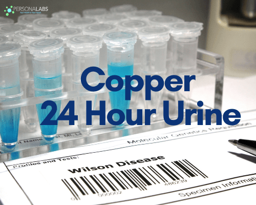 copper 24 hour urine