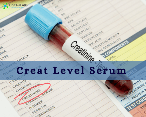 creat level serum