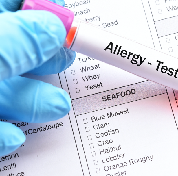 lab order of allergy test