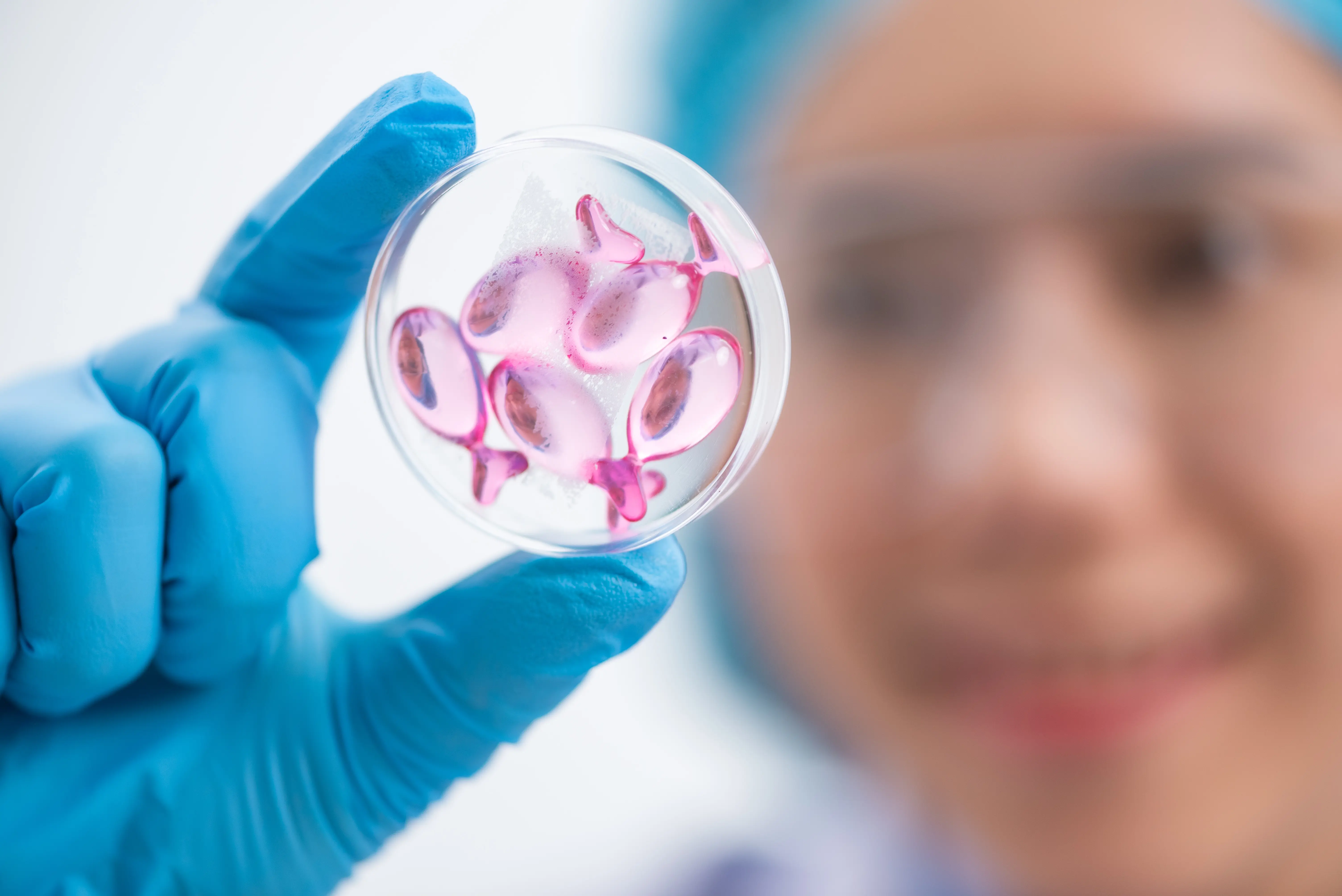 Gamma-glutamyl transferase