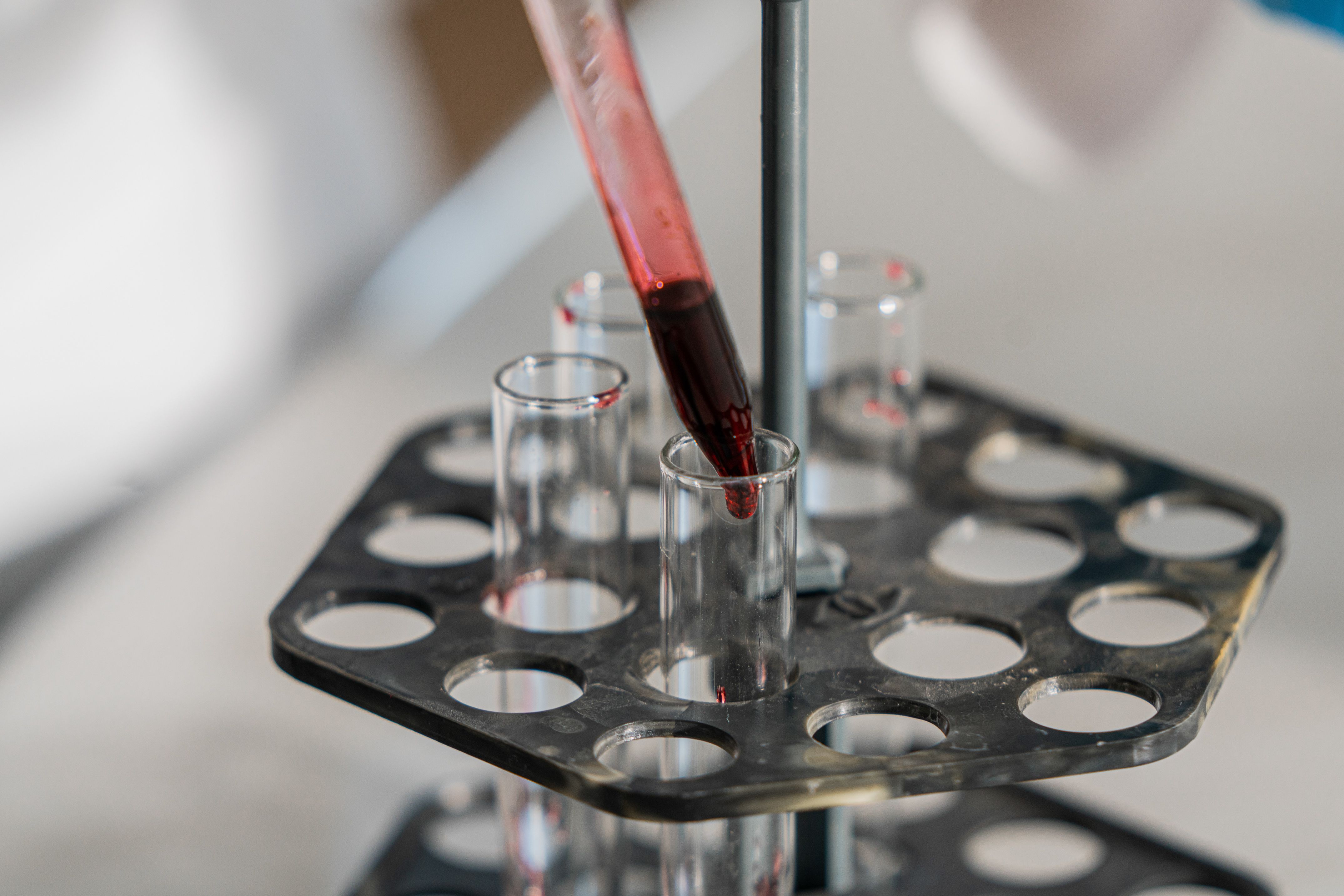 Blood sample used for iron and ferritin testing to evaluate possible iron deficiency